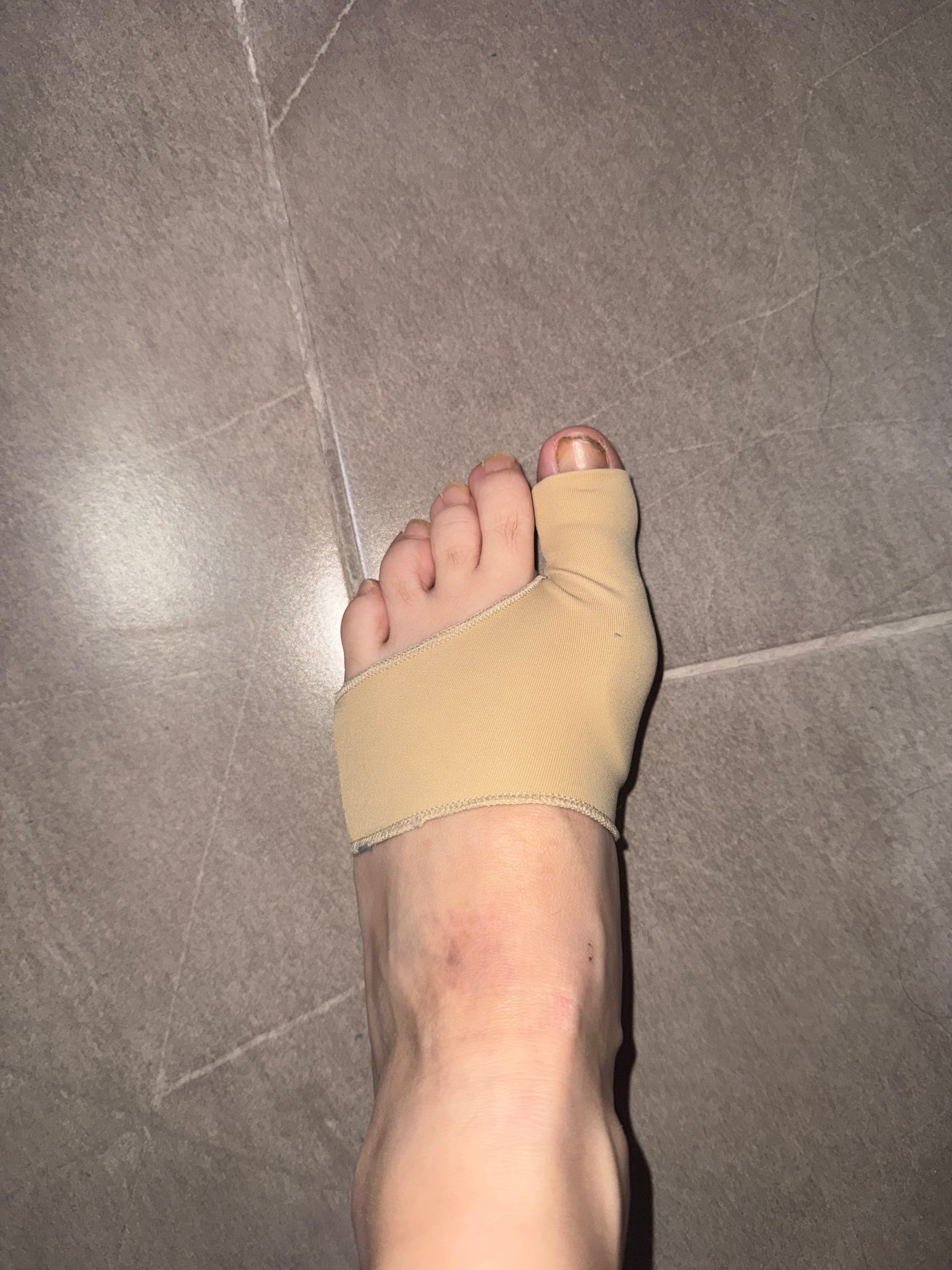 Corrector de juanetes malla