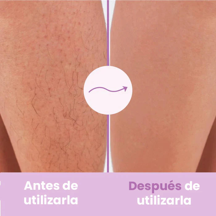 Depiladora Laser IPL